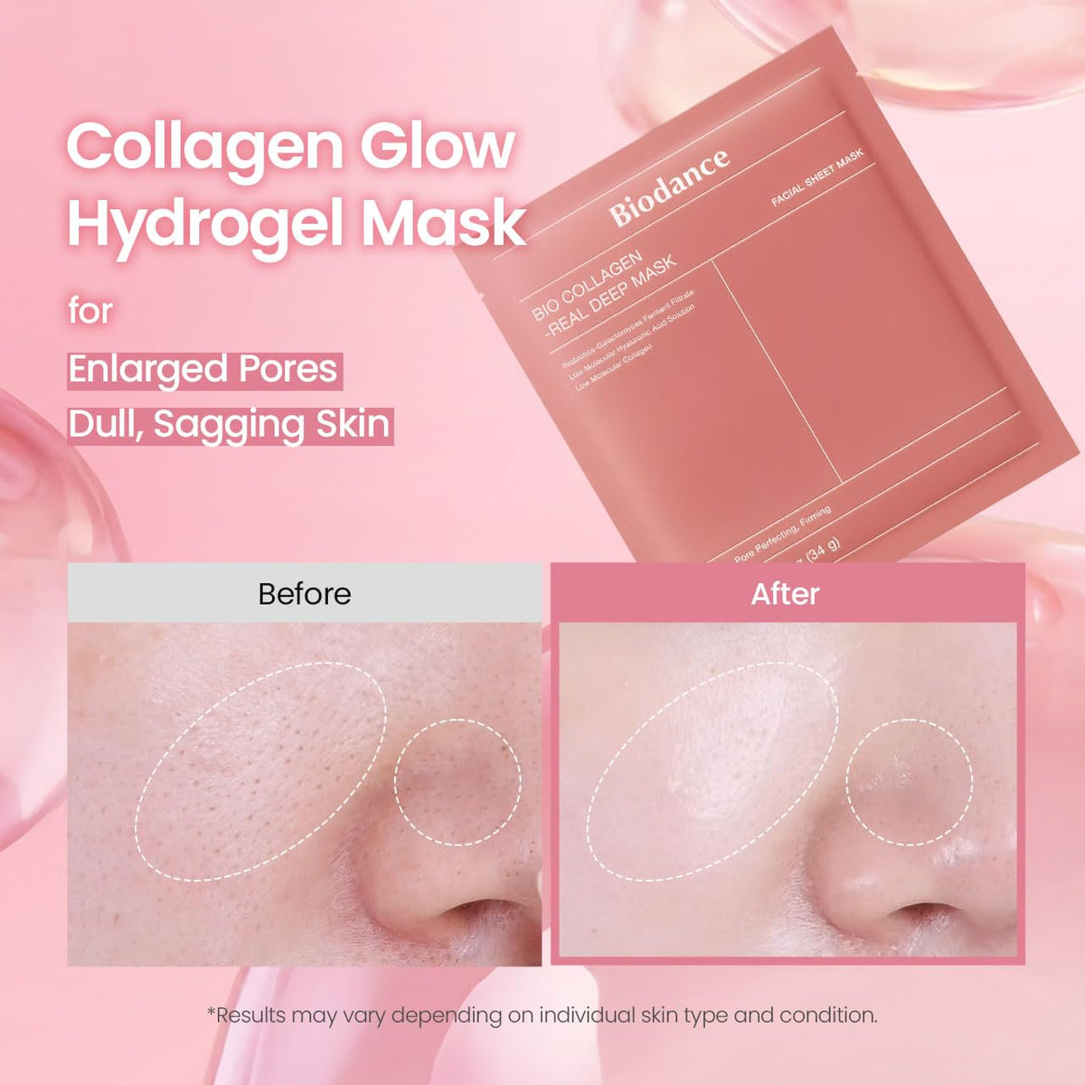 BIODANCE Bio-Collagen Real Deep Mask, Bestselling Hydrating Overnight Hydrogel Mask for Glassy Glowy Skin, Pore Minimizing, Elasticity Improvement, Paraben Free, Fragrance Free, Non-Comedogenic Korean Skincare 34g x 4ea