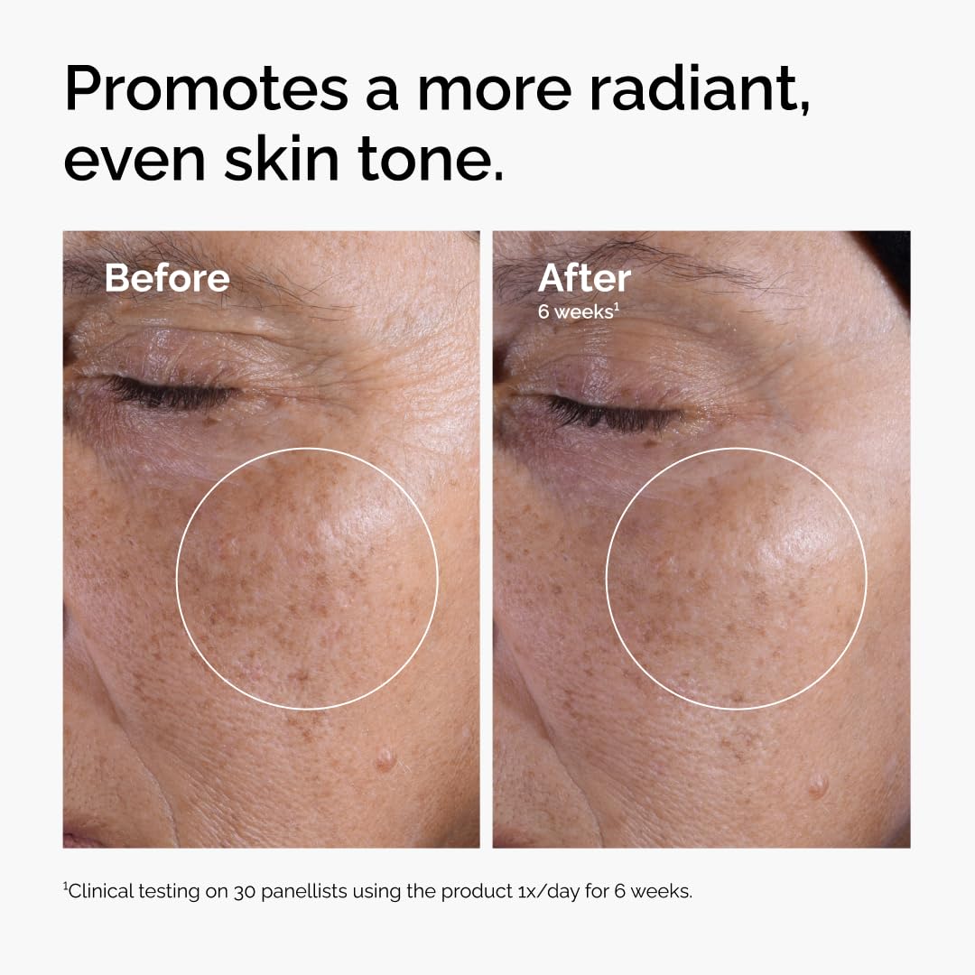 The Ordinary Glycolic Acid 7% Exfoliating Toner, Brightening and Smoothing Daily Toner for More Even-Looking Skin Tone, 240ml