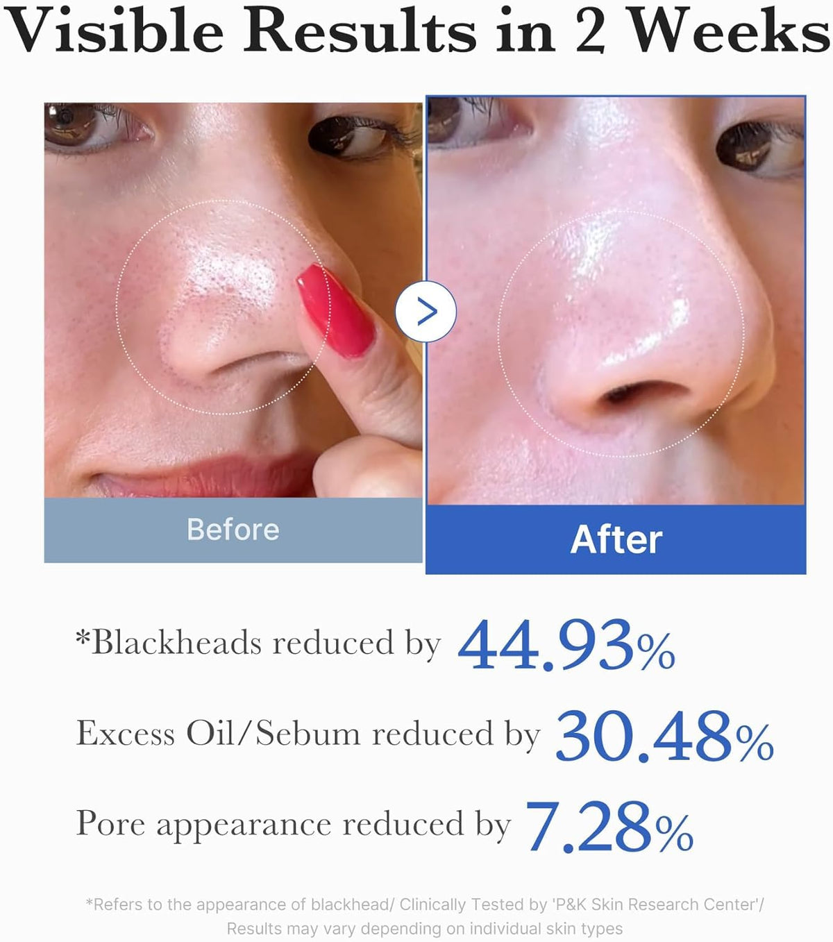 Medicube Zero Pore Pads 2.0 - Dual-Textured Facial Toner Pads for Exfoliation and Minimizing Pores with 4.5% AHA Lactic Acid & 0.45% BHA Salicylic Acid - Ideal for All Skin Types - Korean Skin Care