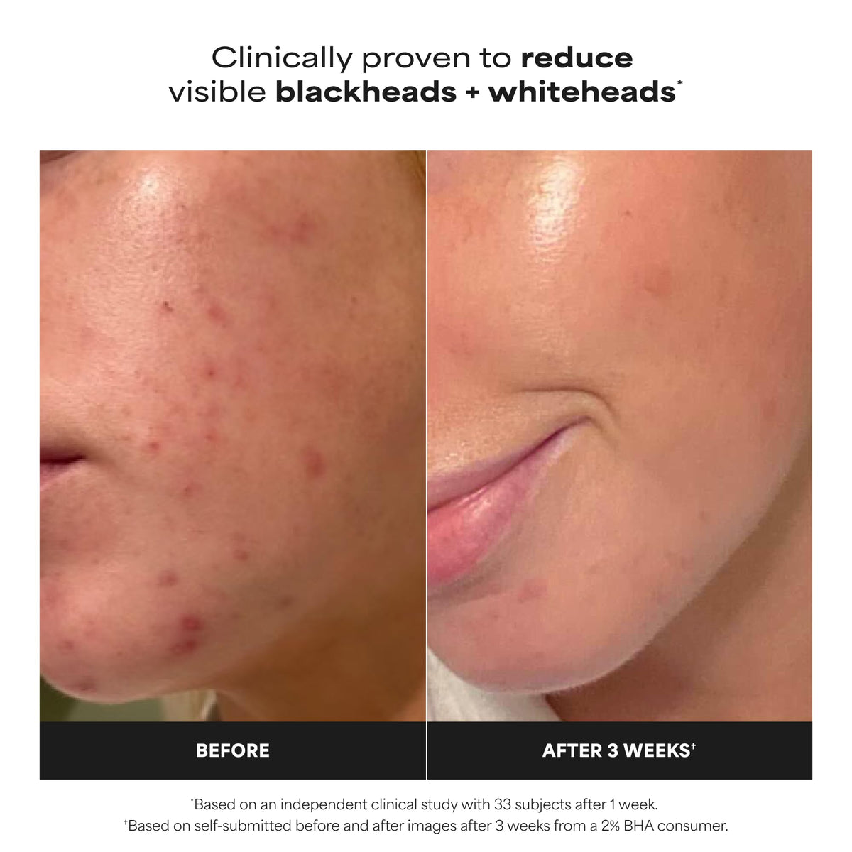 Paula's Choice SKIN PERFECTING 2% BHA Exfoliant, 118 mL Full Size