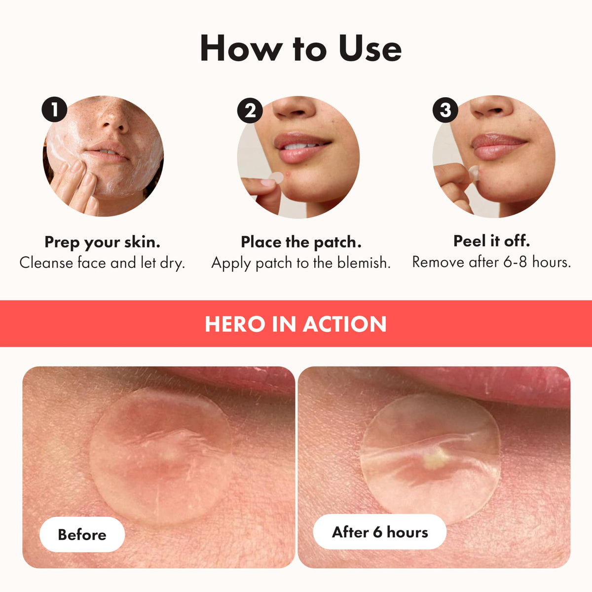 Hero Cosmetics Mighty Patch Original Hydrocolloid Pimple Patches, 36 Ct