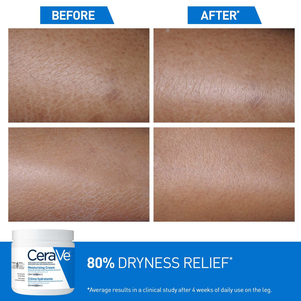 CeraVe Moisturizing Cream for Dry-Very Dry Skin on the Face & Body, 539g