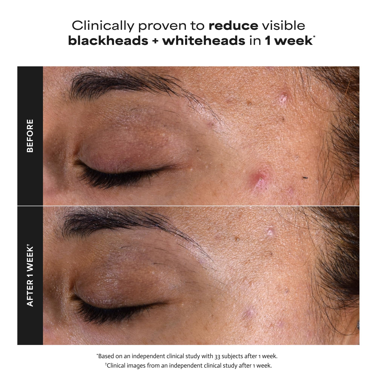 Paula's Choice SKIN PERFECTING 2% BHA Exfoliant, 118 mL Full Size