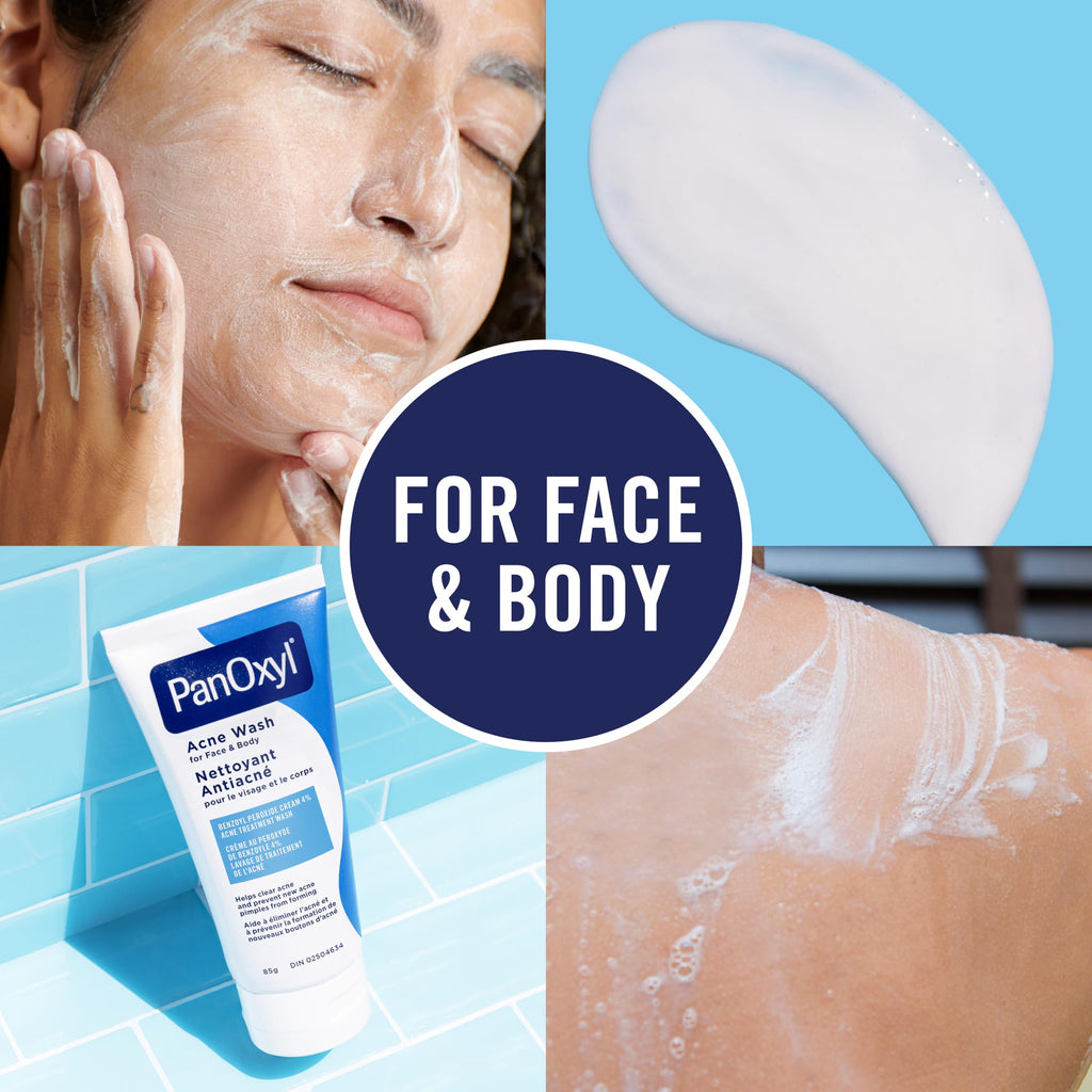 PanOxyl Acne Wash, 4% Benzoyl Peroxide, For Face & Body, 85g