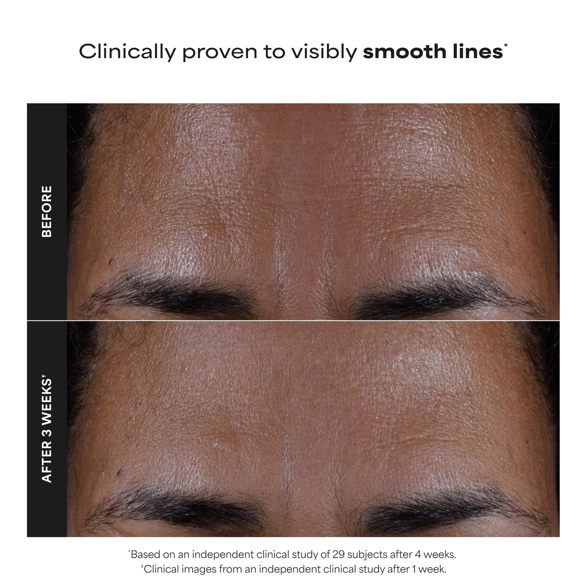 Paula's Choice SKIN PERFECTING 2% BHA Exfoliant, 118 mL Full Size