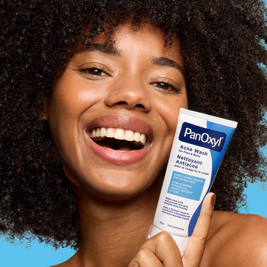 PanOxyl Acne Wash, 4% Benzoyl Peroxide, For Face & Body, 85g